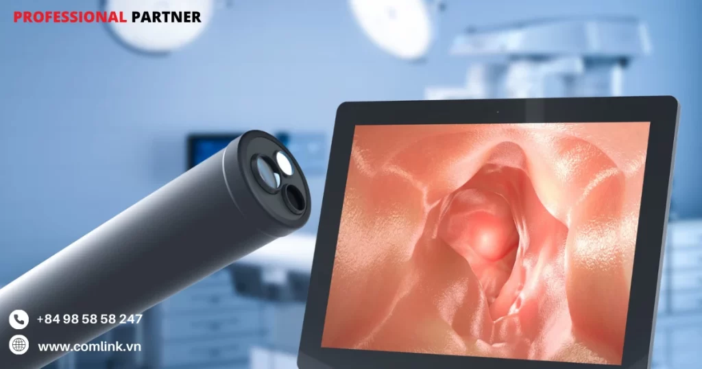 Lợi ích của nội soi