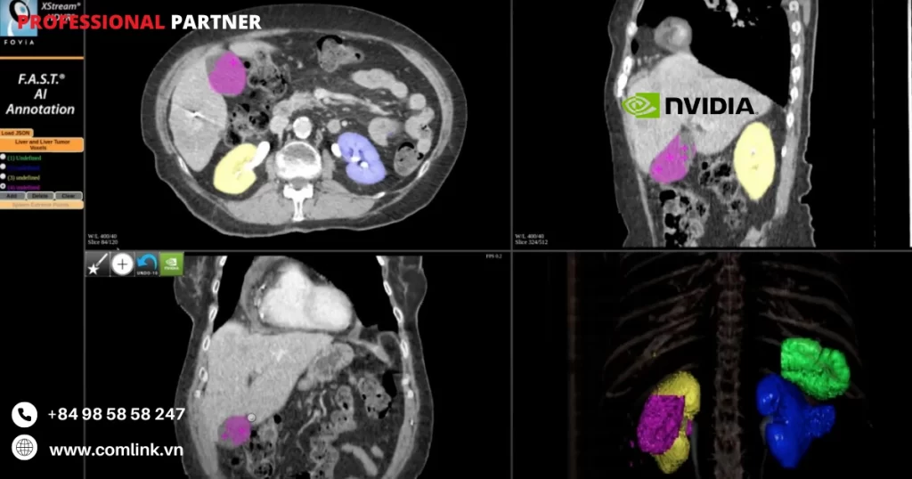 Ứng dụng trong hình ảnh y khoa