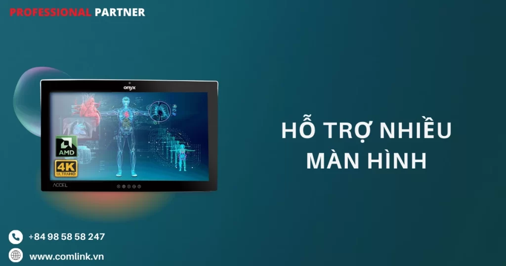 Hỗ trợ nhiều màn hình