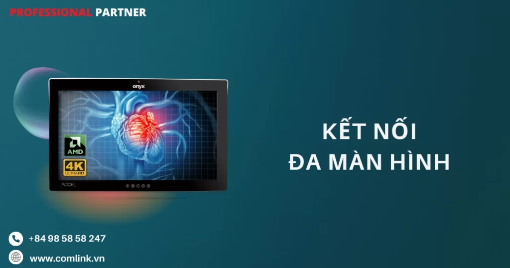 Kết nối đa màn hình