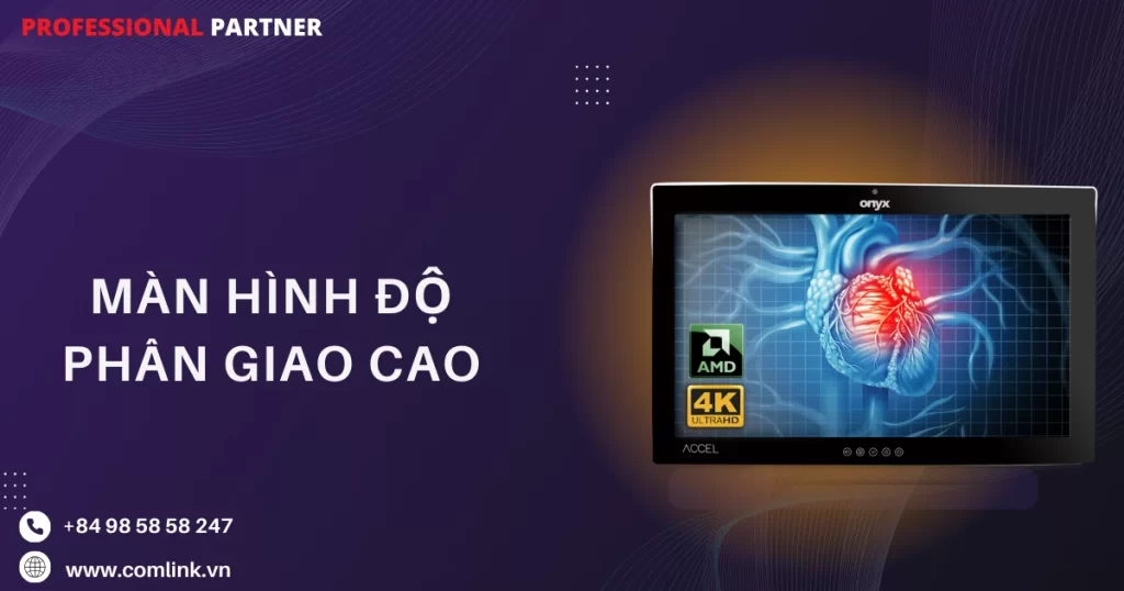 Màn hình độ phân giải cao