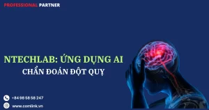 Ứng dụng AI chẩn đoán đột quỵ