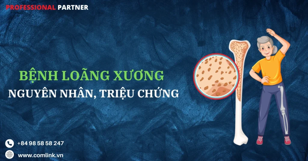 Bệnh loãng xương
