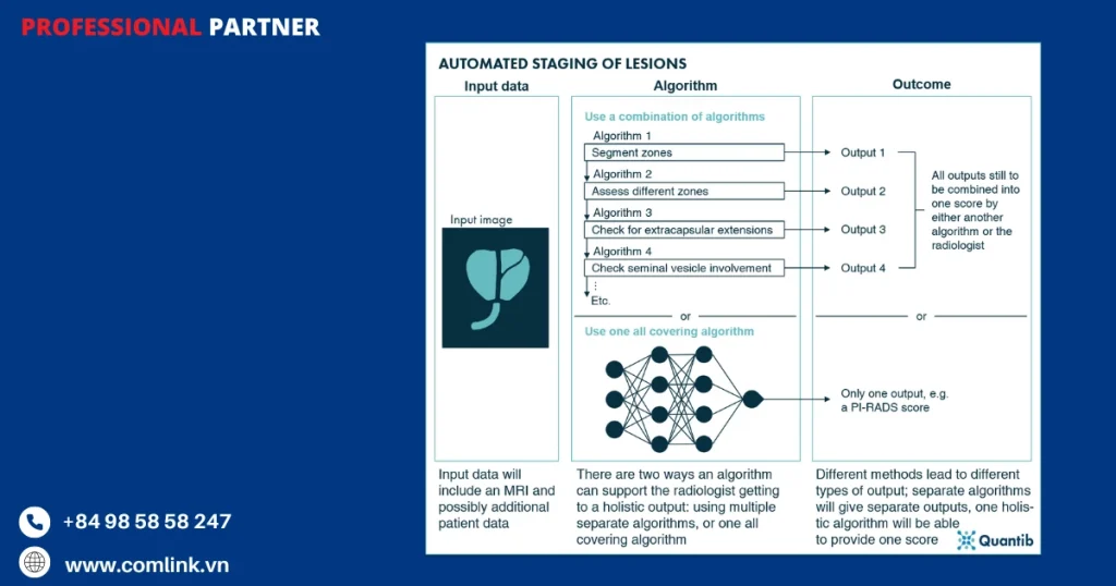 Chấm điểm PI-RADS và phân loại khối u
