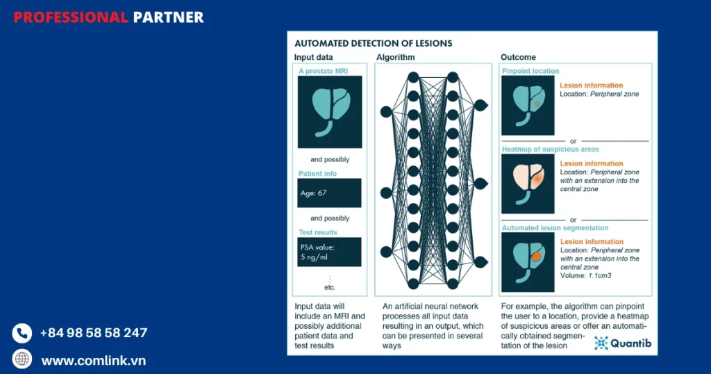 Phát hiện và phân loại tổn thương tuyến tiền liệt