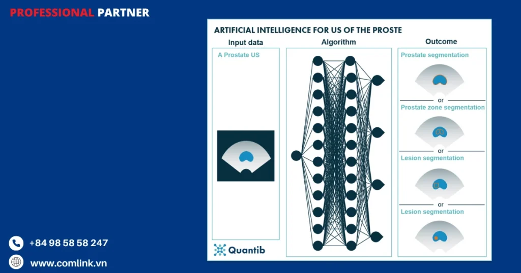 Siêu âm qua trực tràng TRUS