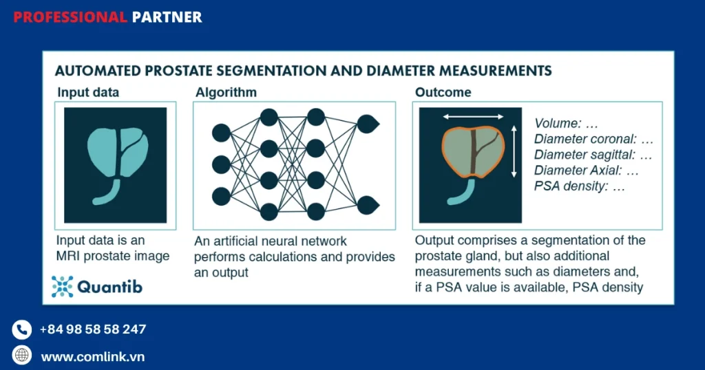 Tự động hóa đo thể tích và mật độ PSA