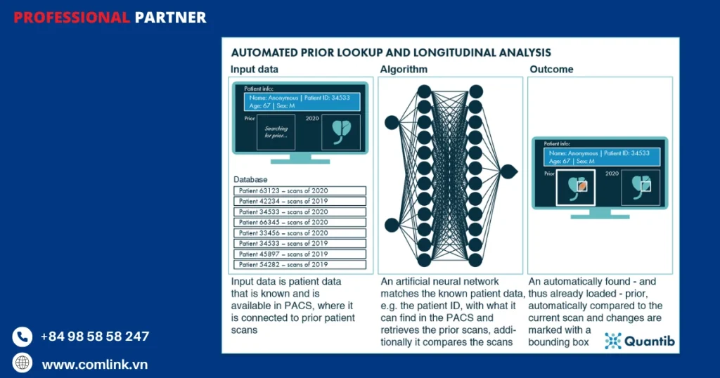 Tự động tra cứu trước và so sánh theo chiều dọc