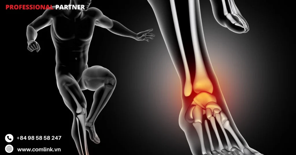 Tư thế khom lương