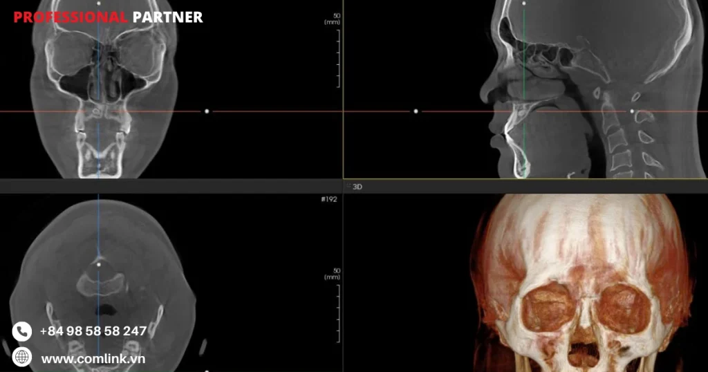 Phần mềm AImodel: Phân tích răng tự động