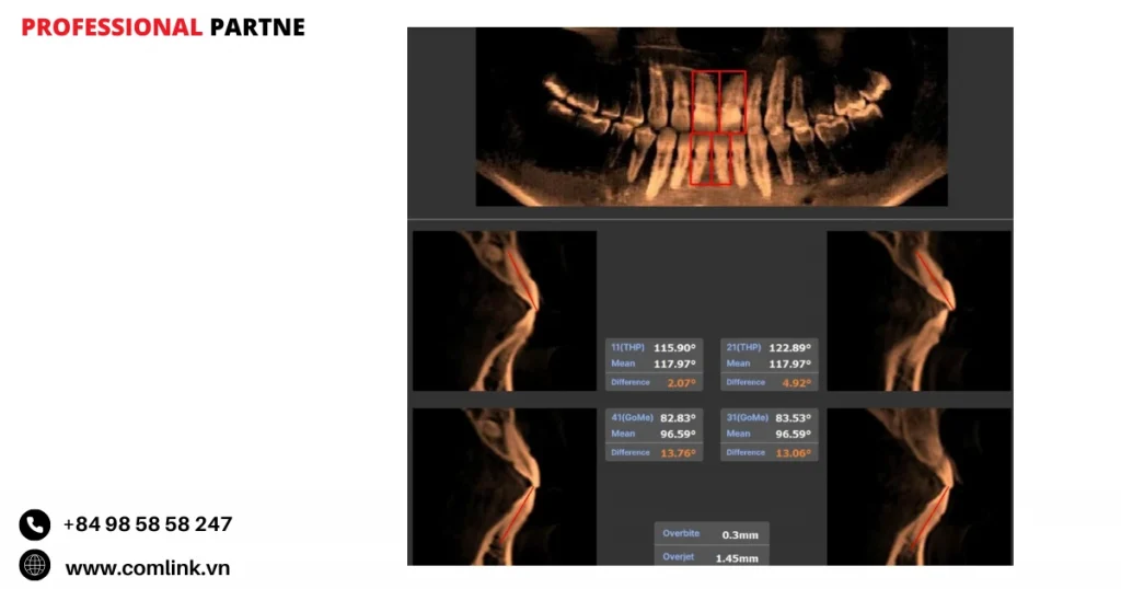 Phần mềm Aisoft: Phân tích mô mềm tự động