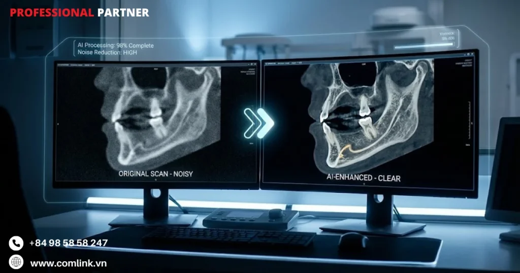 Giảm nhiễu và nâng cao chất lượng ảnh CBCT